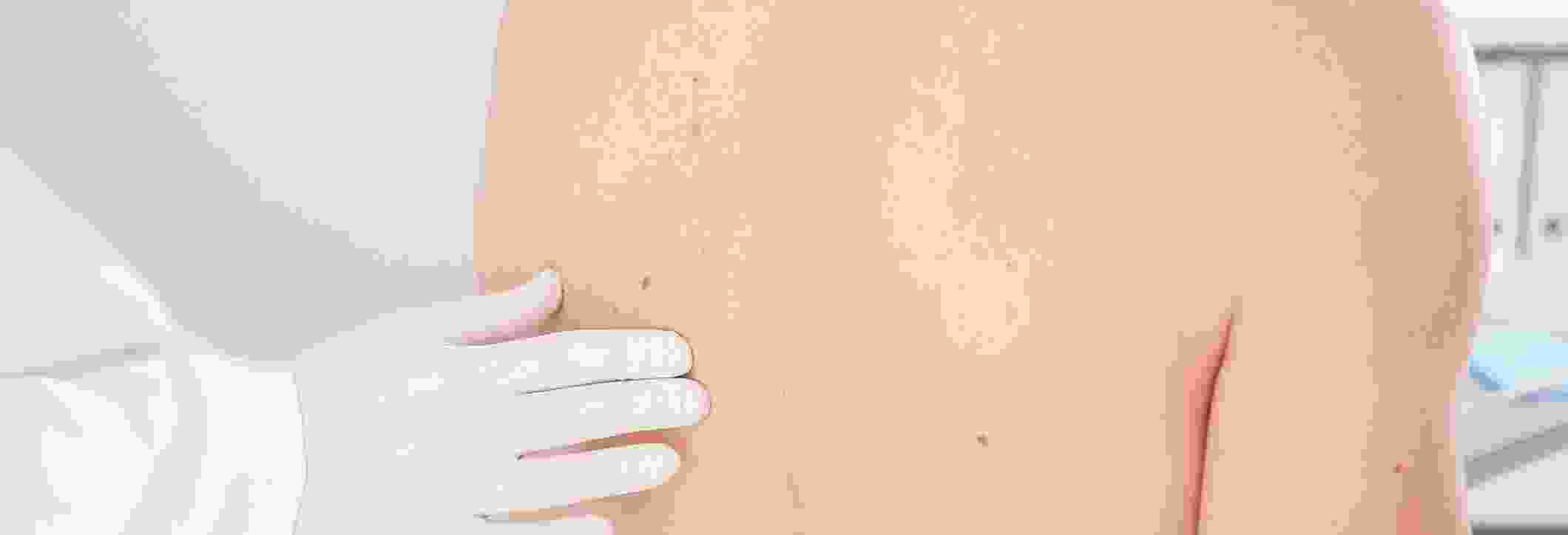 Optimum Dermatology